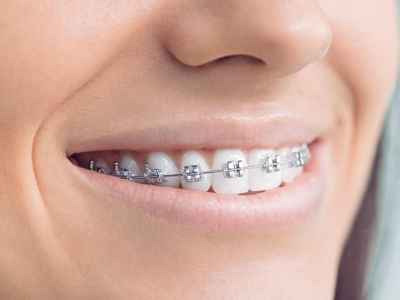 Orthodontics. Special Interest